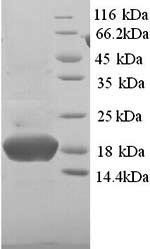 14KDA phosphohistidine phosphatase (PHPT1), human, recombinant