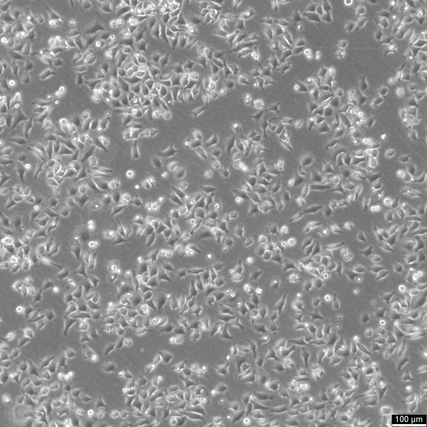 HK-CRISPR-mEGFP-Nup153 Cells