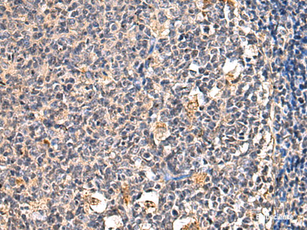 Anti-ENTPD1