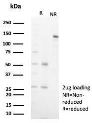 Anti-MR1 / MHC class I related protein 1, clone MR1/7579