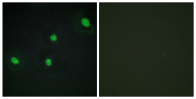 Anti-CdcA4