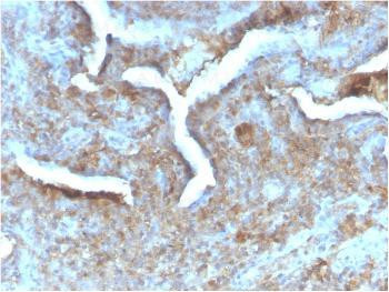 Anti-Thymidine Phosphorylase / PD-ECGF (Angiogenesis Marker) Monoclonal Antibody (Clone: TYMP/2890R)