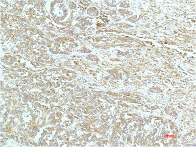 Anti-ACTN1 Monoclonal