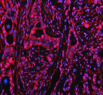 Anti-PPP1R8 / Protein phosphatase 1 regulatory subunit 8
