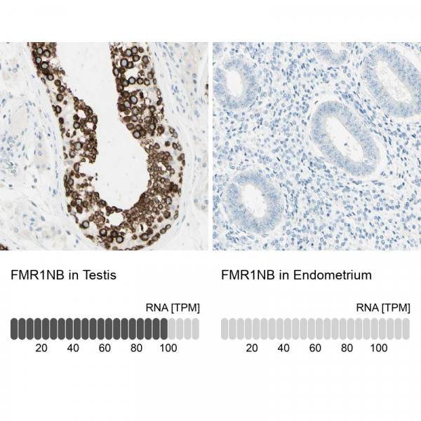Anti-FMR1NB