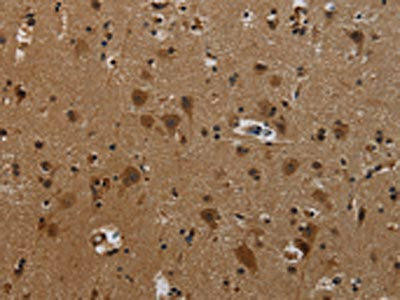 Anti-PCDHB11