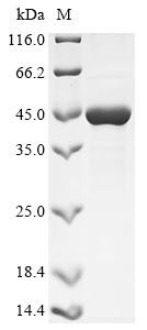 Lys-gingipain 381 (kgp), partial, Porphyromonas gingivalis, recombinant