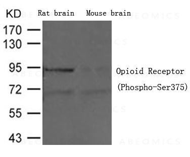 Anti-phospho-Opioid Receptor (Ser375)
