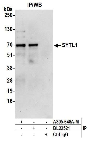 Anti-SYTL1