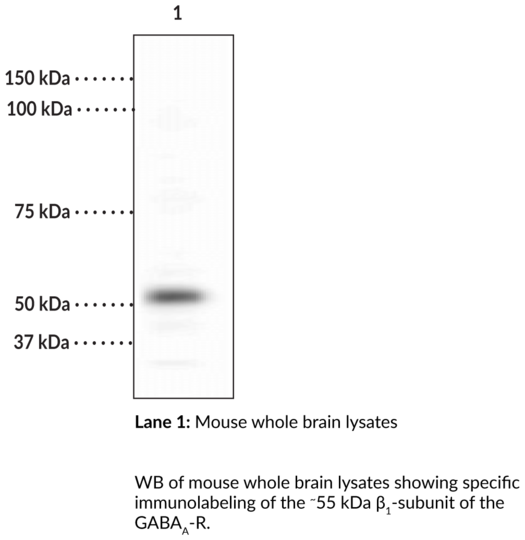 Anti-GABAA Receptor beta1 Subunit
