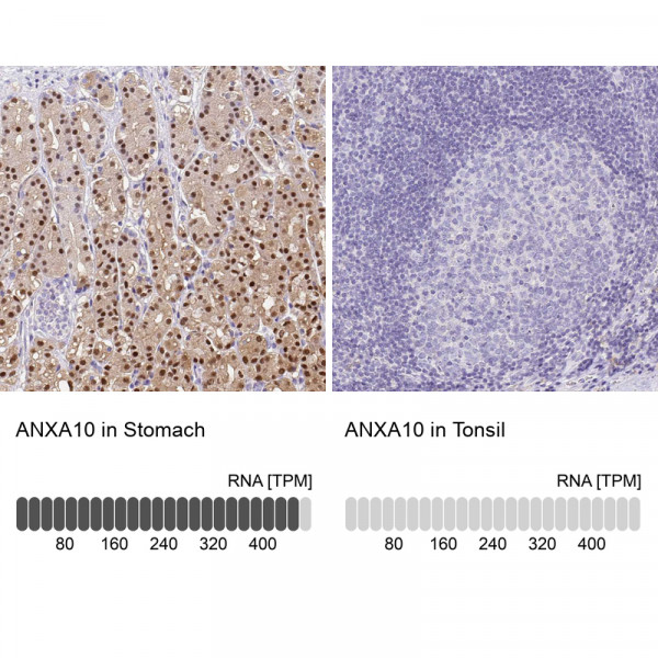 Anti-ANXA10