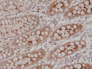 Anti-CEA (human), Rabbit Monoclonal (RM326)