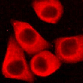 Anti-DR5, clone 7F4-F8-G11