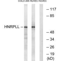 Anti-HNRNPLL
