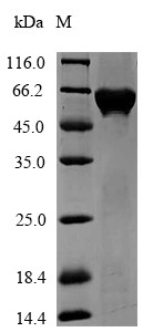 3-Phosphoshikimate 1-carboxyvinyltransferase (aroA), Agrobacterium sp., recombinant