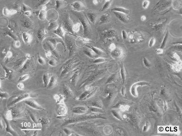 RCC-GH Cells