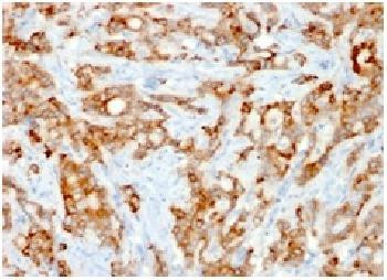 Anti-Beta-2 Microglobulin (Renal Failure &amp;Tumor Marker) Recombinant Mouse Monoclonal Antibody (clone
