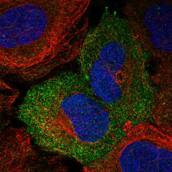 Anti-NECTIN4