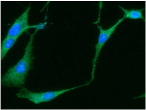 Anti-NSE, clone 17D10