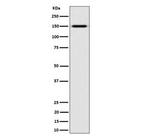Anti-NKCC2 / Na-K-2Cl cotransporter 2 / SLC12A1, clone 29S41