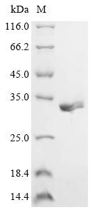 Protein Rep78 (Rep78), partial, Adeno-associated virus 2, recombinant