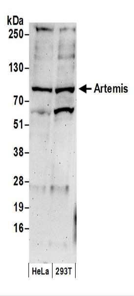 Anti-Artemis