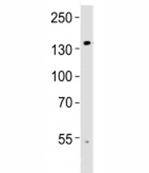 Anti-TRPM8