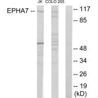 Anti-EPHA7