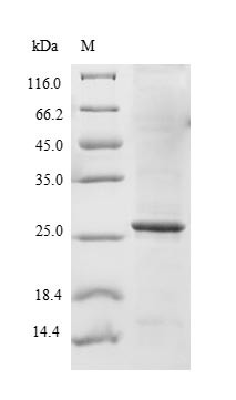 Sodium-dependent phosphate transport protein 2B (SLC34A2), partial, human, recombinant