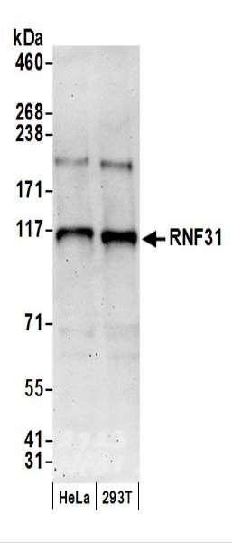 Anti-RNF31