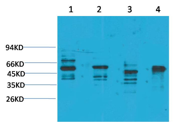 Anti-KCNN4(SK4)