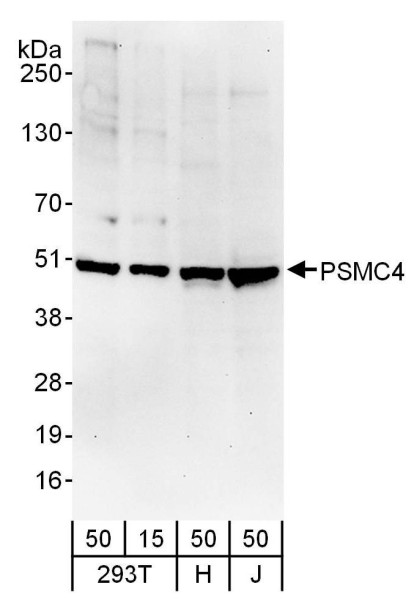 Anti-PSMC4