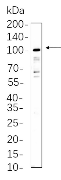Anti-Recombinant STAT5A/B, clone 4B15