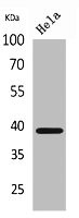 Anti-CXCR6