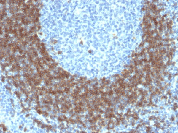 Anti-CD79b (B-Cell Marker), clone IGB/1842