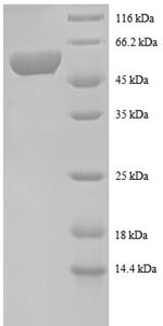 Spermidine synthase (SRM), partial, human, recombinant