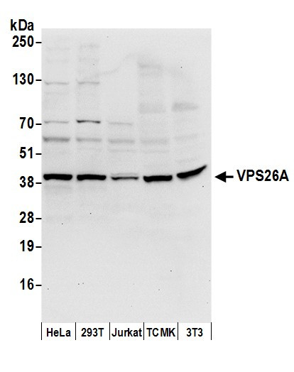 Anti-VPS26A
