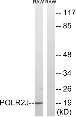 Anti-POLR2J1