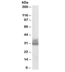 Anti-Cathepsin F