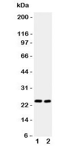 Anti-IL6