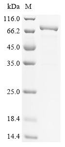 Myosin-6 (MYH6), partial, Biotinylated, human, recombinant