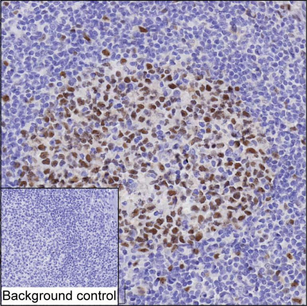 Anti-PCNA