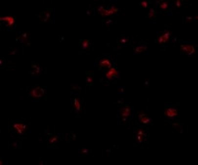 Anti-DLGAP1 / SAPAP1 / GKAP
