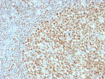Anti-OCT-2 (POU2F2) (B-Cell Marker) Monoclonal Antibody (Clone: 86474)