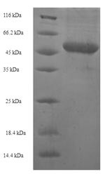 Pro-neuregulin-2, membrane-bound isoform (NRG2),partial, human, recombinant