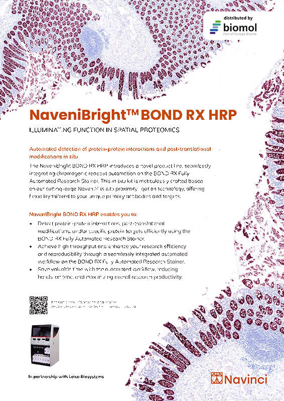 NaveniBright BOND RX HRP