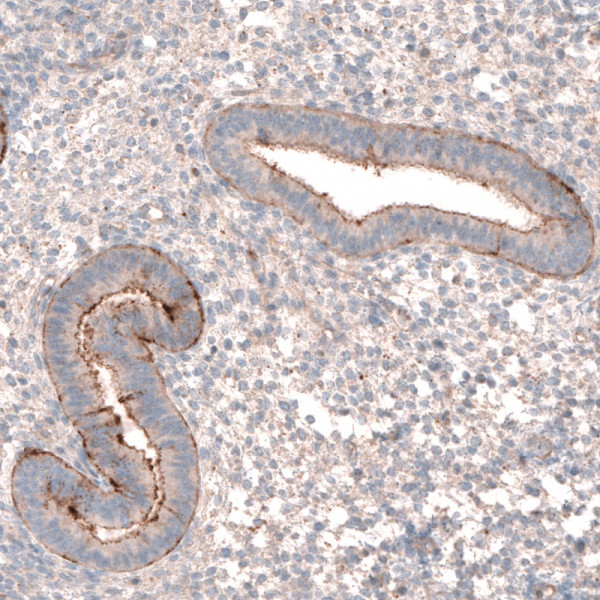 Anti-LRRC15