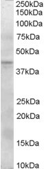 Anti-MEPI / SERPINI2, Internal