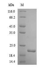 Integrin alpha-2 (ITGA2), partial, human, recombinant