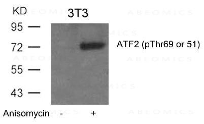 Anti-phospho-ATF2 (Thr69 or 51)